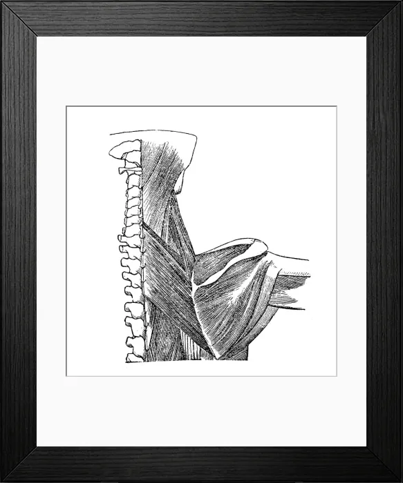 Framed Print : Back muscles Framed Print : Back muscles