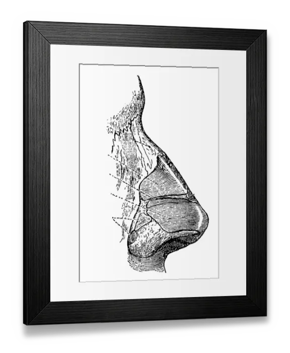 Framed Print : Human nose section Framed Print : Human nose section