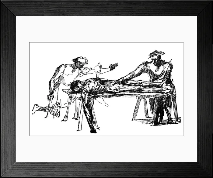 Framed Print : Michael Angelo dissection Framed Print : Michael Angelo dissection