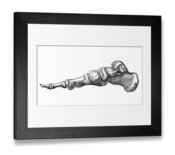 Framed Print : Foot bones, profile view Framed Print : Foot bones, profile view