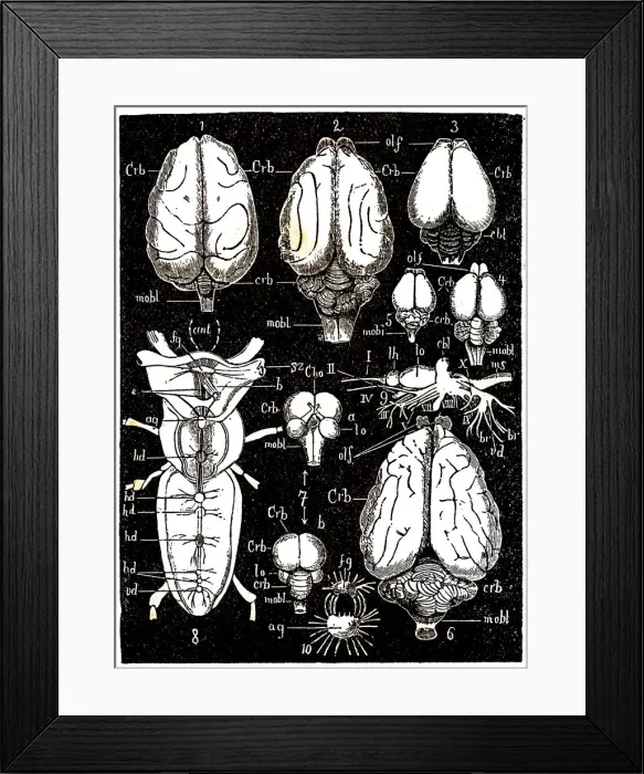 Framed Print : CNS parts. Middle and anterior-posterior section of the brain Framed Print : CNS parts. Middle and anterior-posterior section of the brain