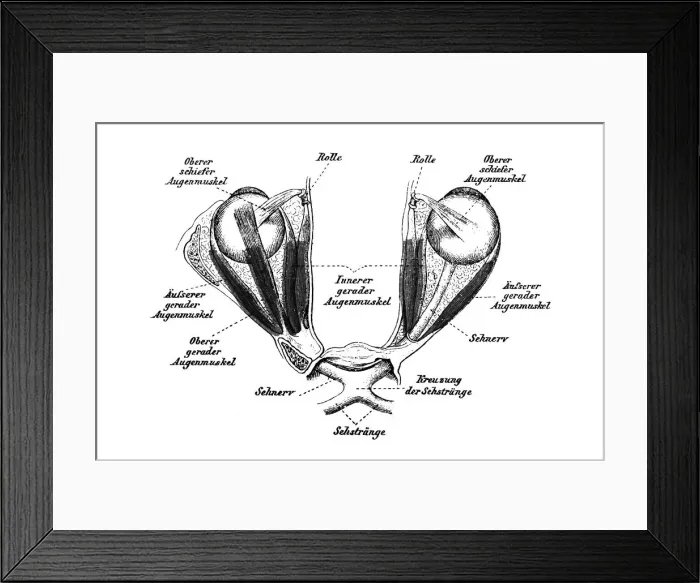 Framed Print : Eye muscles Framed Print : Eye muscles