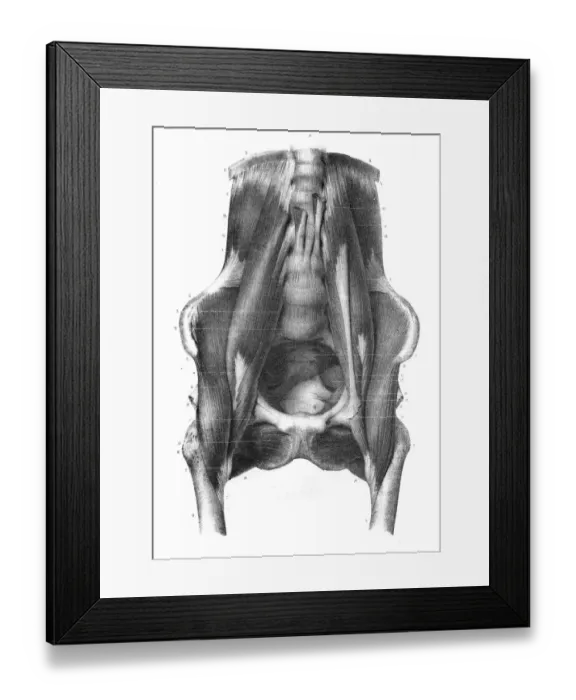 Framed Print : Lumbar region anatomy engraving 1866 Framed Print : Lumbar region anatomy engraving 1866