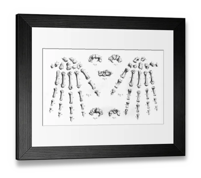 Framed Print : Hand bones anatomy engraving 1866 Framed Print : Hand bones anatomy engraving 1866