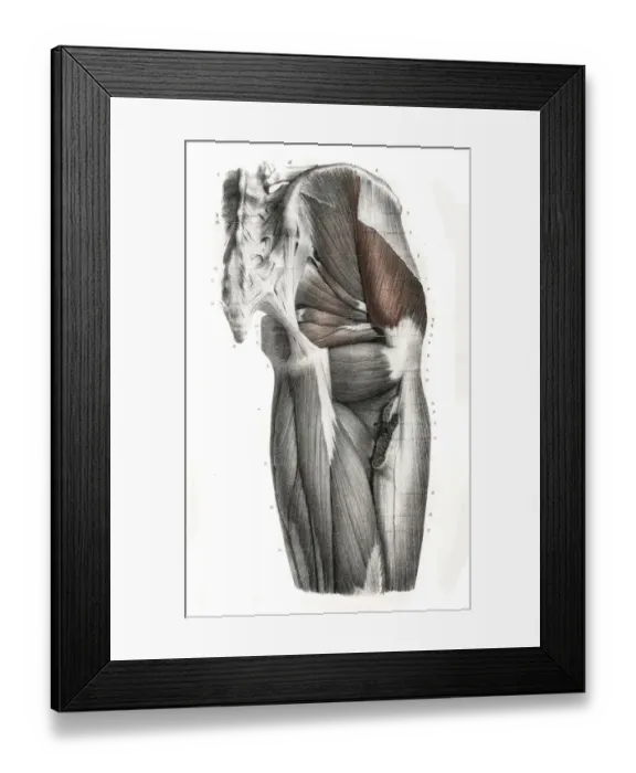 Framed Print : Pelvic femoral region anatomy engraving 1866