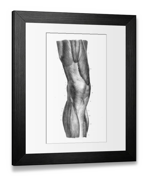Framed Print : Anterior knee region anatomy engraving 1866 Framed Print : Anterior knee region anatomy engraving 1866