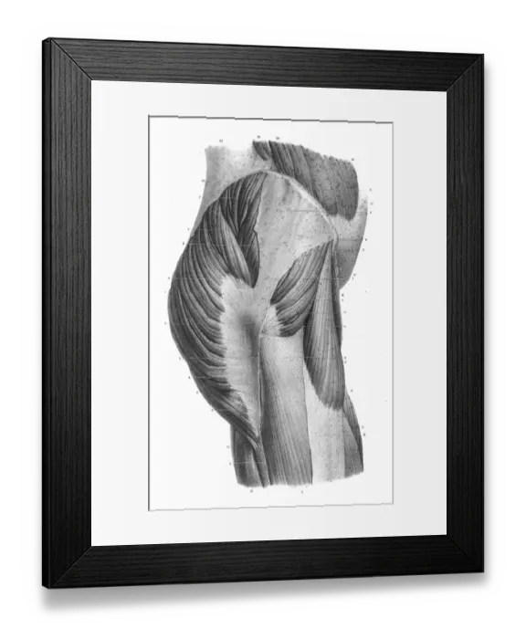 Framed Print : Pelvic femoral region anatomy engraving 1866