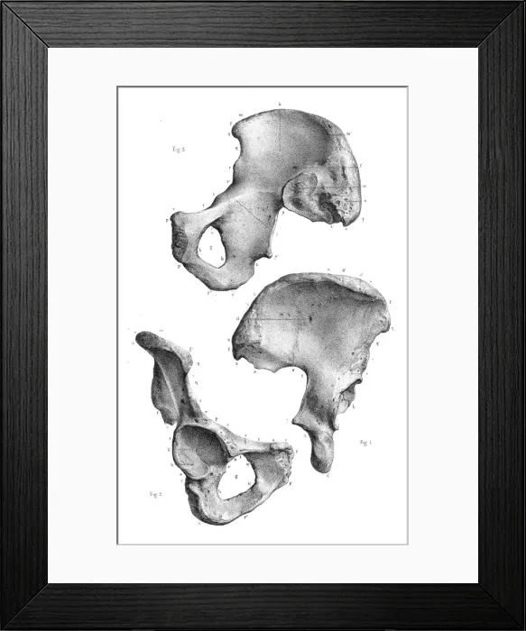 Framed Print : Abdominal limbs anatomy engraving 1866 Framed Print : Abdominal limbs anatomy engraving 1866