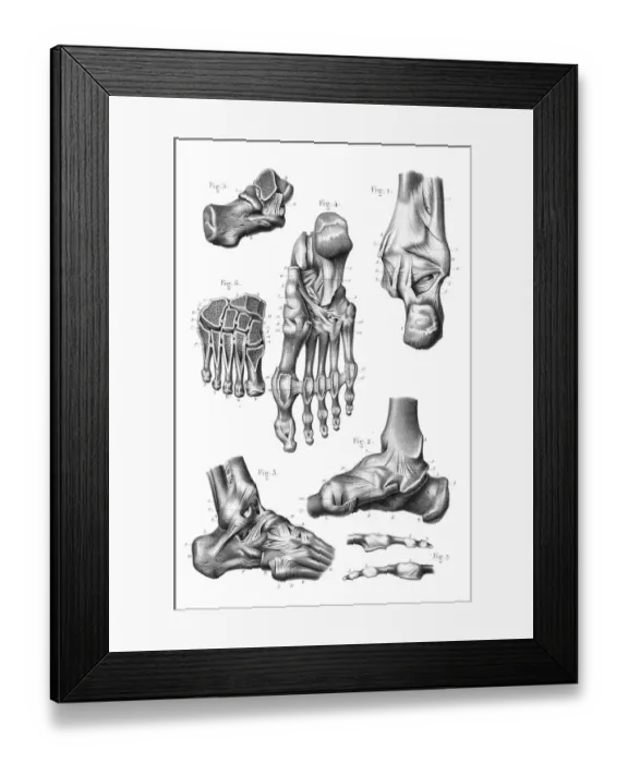 Framed Print : Foot joint anatomy engraving 1866 Framed Print : Foot joint anatomy engraving 1866