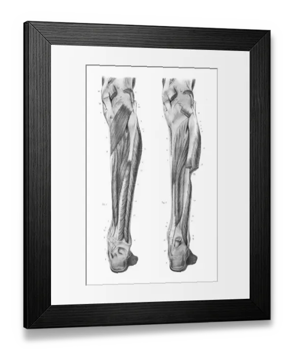 Framed Print : Posterior leg region anatomy engraving 1866