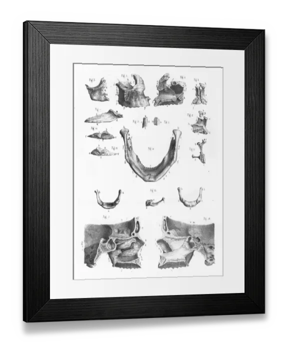 Framed Print : Face bones anatomy engraving 1866 Framed Print : Face bones anatomy engraving 1866