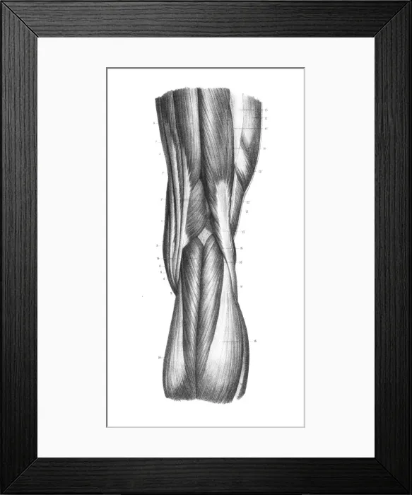 Framed Print : Posterior part of knee engraving 1866 Framed Print : Posterior part of knee engraving 1866