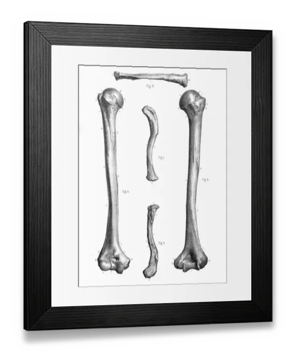 Framed Print : Thoracic limbs anatomy engraving 1866 Framed Print : Thoracic limbs anatomy engraving 1866