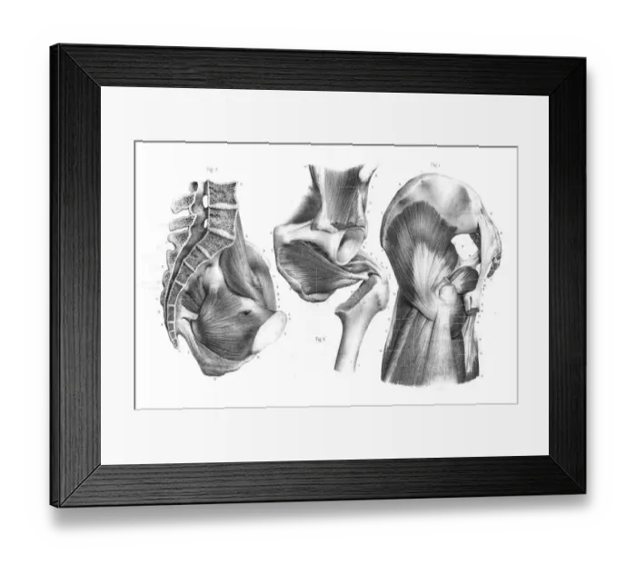 Framed Print : Pelvic femoral region anatomy engraving 1866 Framed Print : Pelvic femoral region anatomy engraving 1866