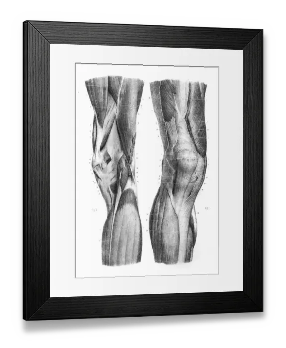Framed Print : Anterior knee region anatomy engraving 1866 Framed Print : Anterior knee region anatomy engraving 1866