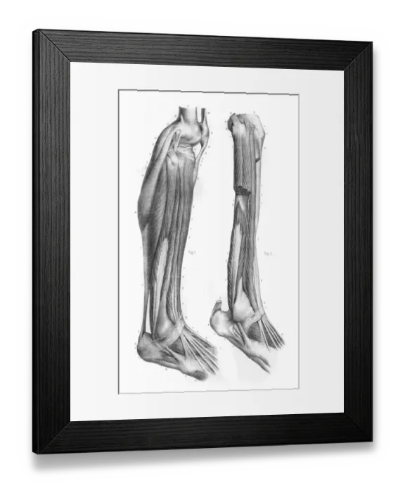Framed Print : External leg region anatomy engraving 1866