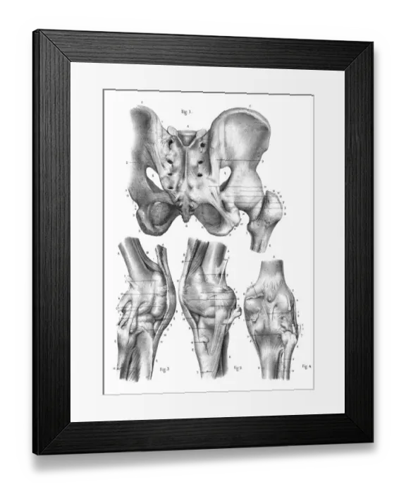 Framed Print : Knee anatomy engraving 1866 Framed Print : Knee anatomy engraving 1866