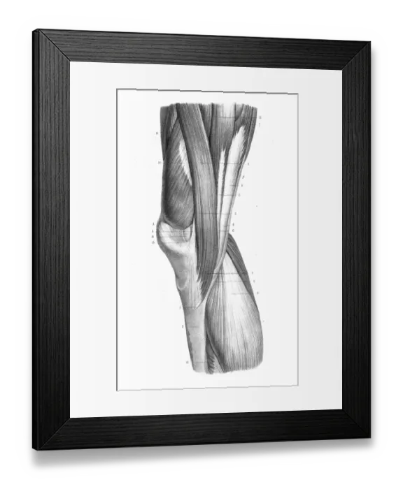 Framed Print : Internal knee region anatomy engraving 1866 Framed Print : Internal knee region anatomy engraving 1866