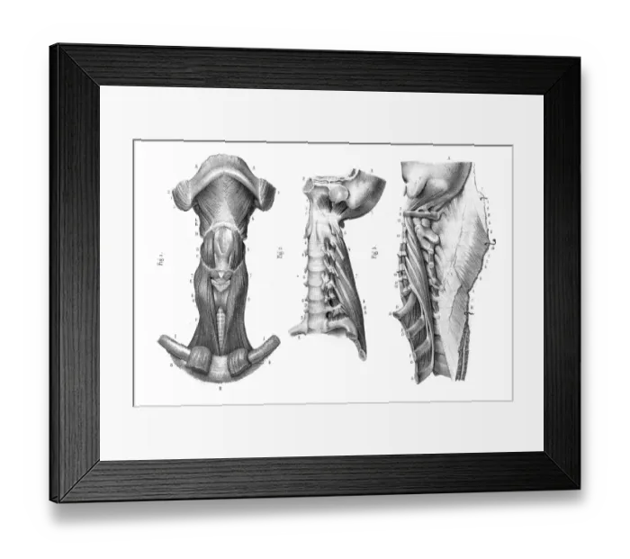 Framed Print : Neck vertebra anatomy engraving 1866 Framed Print : Neck vertebra anatomy engraving 1866
