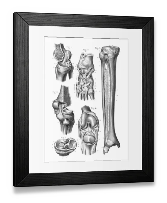 Framed Print : Knee foot joint anatomy engraving 1866