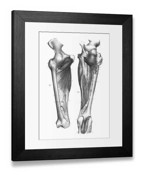 Framed Print : Knee region anatomy engraving 1866 Framed Print : Knee region anatomy engraving 1866