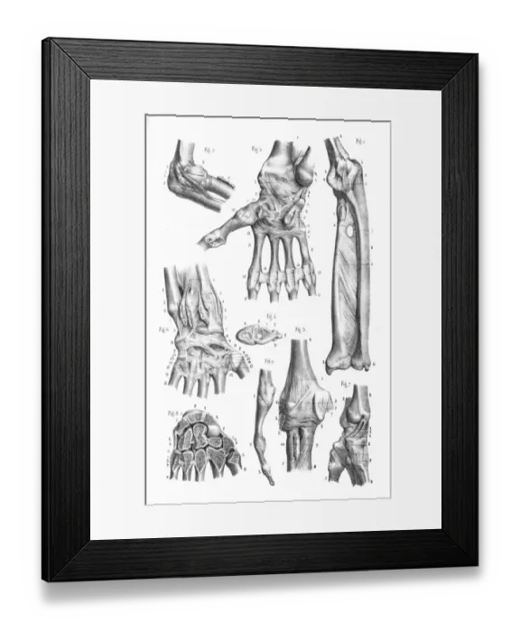 Framed Print : Articulations anatomy engraving 1866 Framed Print : Articulations anatomy engraving 1866