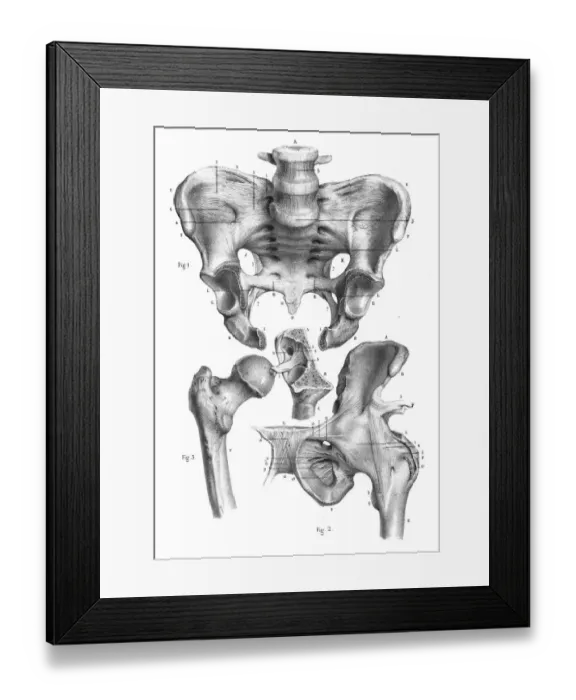 Framed Print : Hip anatomy engraving 1866 Framed Print : Hip anatomy engraving 1866