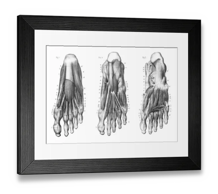 Framed Print : Foot Plantar region anatomy engraving 1866 Framed Print : Foot Plantar region anatomy engraving 1866