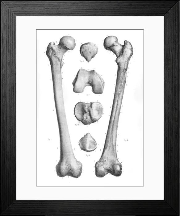 Framed Print : Femur anatomy engraving 1866