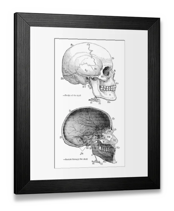 Framed Print : Human skull anatomy engraving 1878 Framed Print : Human skull anatomy engraving 1878