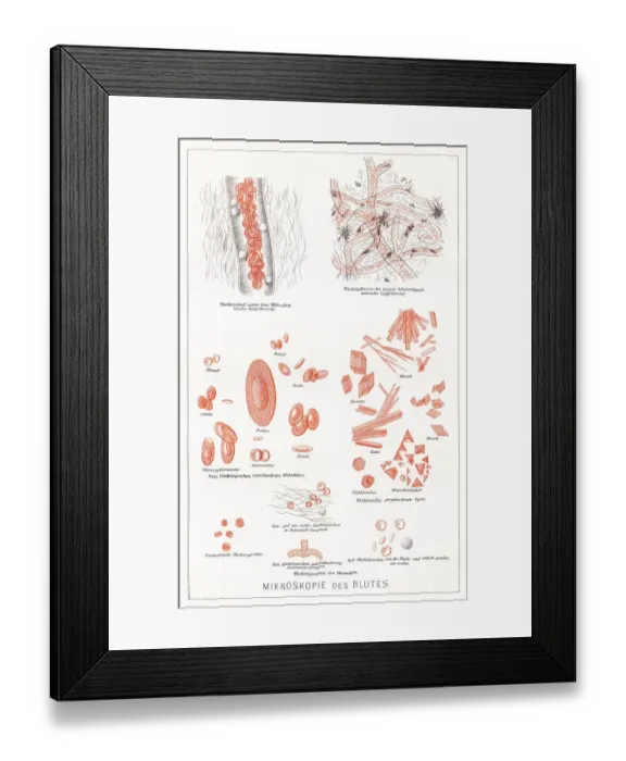 Framed Print : Microscopy of the blood anatomy engraving 1857 Framed Print : Microscopy of the blood anatomy engraving 1857