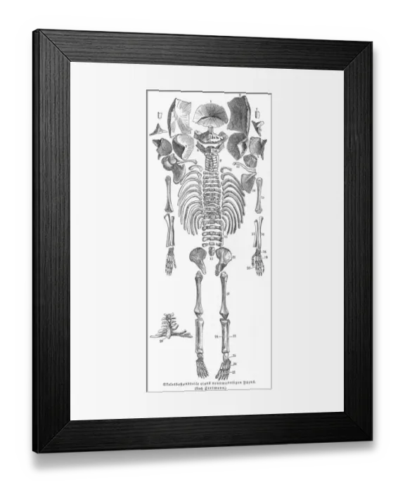 Framed Print : Fetus skeleton anatomy engraving 1857