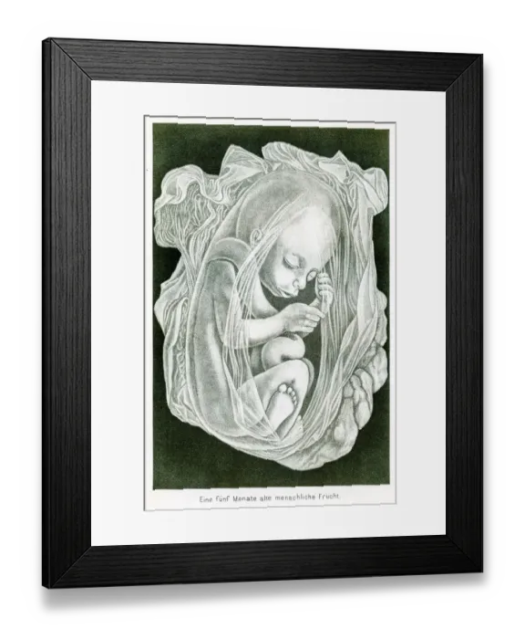 Framed Print : Five month baby anatomy engraving 1857 Framed Print : Five month baby anatomy engraving 1857