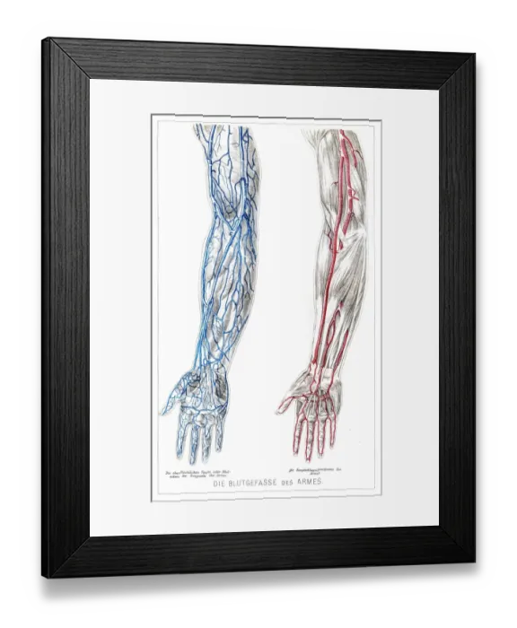 Framed Print : Arms Blood vessels anatomy engraving 1857 Framed Print : Arms Blood vessels anatomy engraving 1857