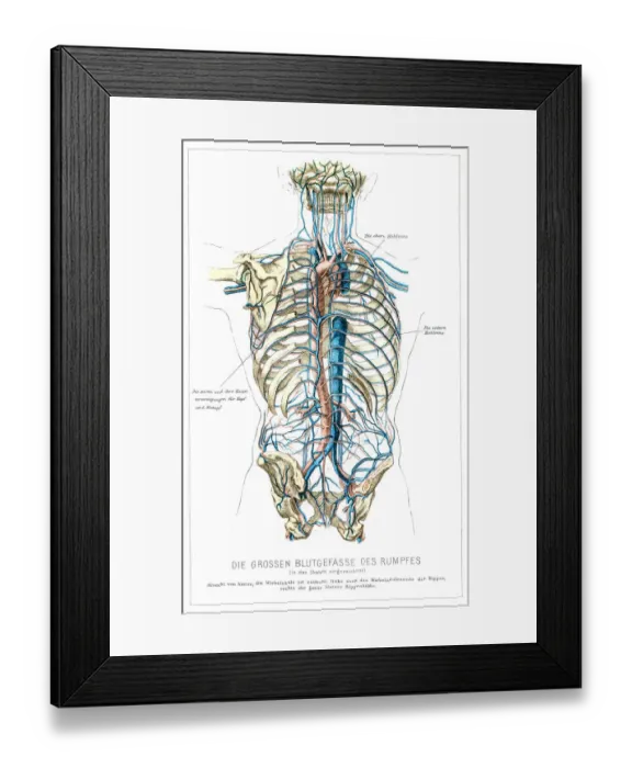 Framed Print : Blood vessels anatomy engraving 1857 Framed Print : Blood vessels anatomy engraving 1857