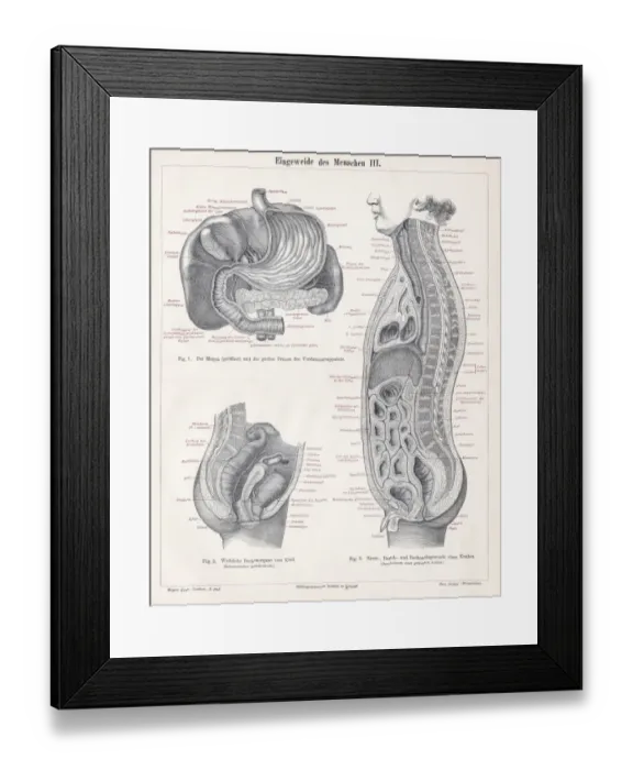 Framed Print : Stomach digestive system engraving 1895 Framed Print : Stomach digestive system engraving 1895