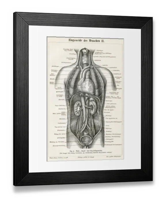 Framed Print : Stomach digestive system engraving 1895 Framed Print : Stomach digestive system engraving 1895