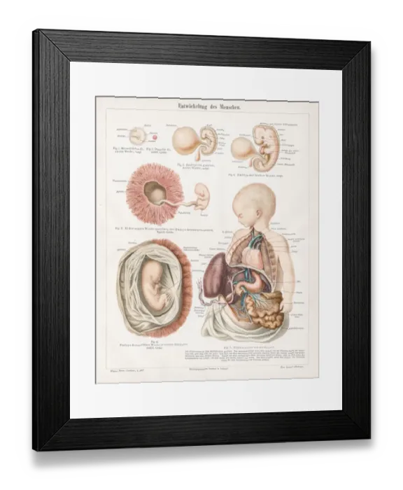 Framed Print : Development of human chromolithograph 1895 Framed Print : Development of human chromolithograph 1895