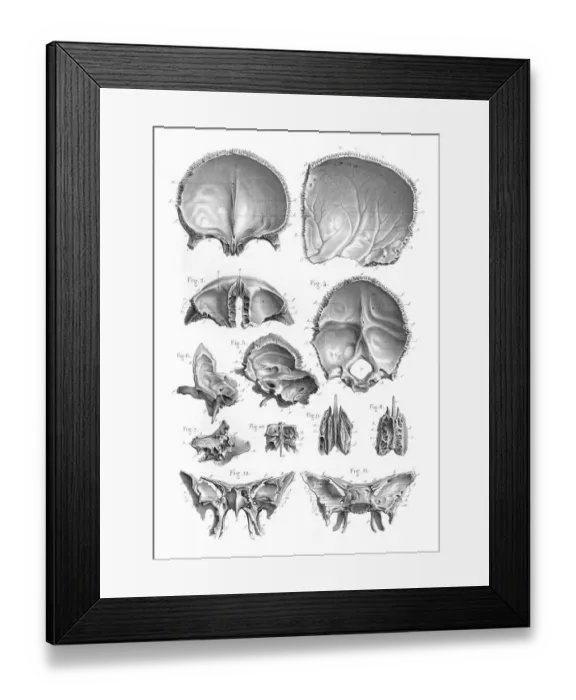 Framed Print : Bones of the head engraving 1896 Framed Print : Bones of the head engraving 1896