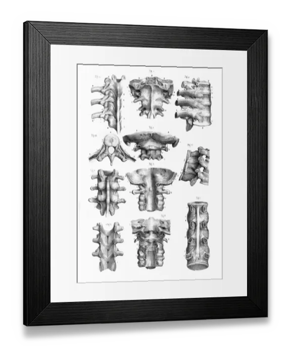 Framed Print : Spine and Ligaments anatomy illustration 1866 Framed Print : Spine and Ligaments anatomy illustration 1866