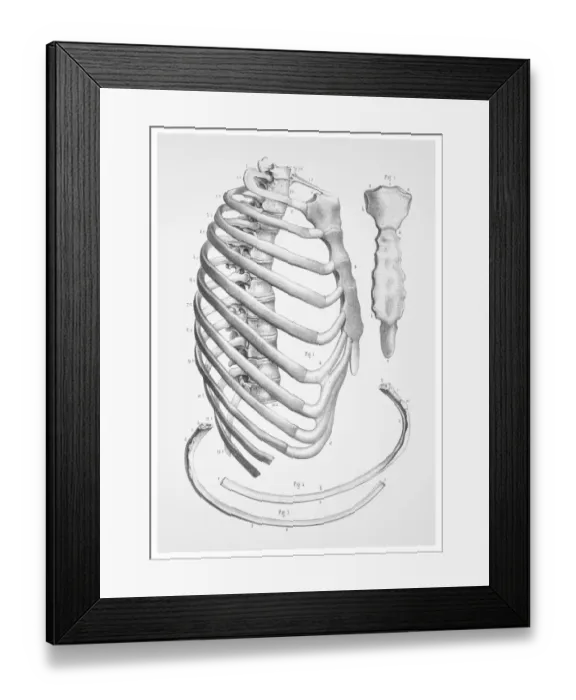 Framed Print : Thorax Ribs cage anatomy illustration 1866