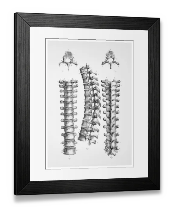Framed Print : Dorsal vertebrae anatomy illustration 1866 Framed Print : Dorsal vertebrae anatomy illustration 1866