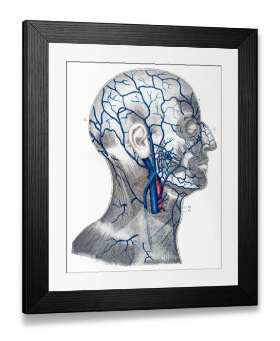 Framed Print : Veins of the cranium and face engraving 1894 Framed Print : Veins of the cranium and face engraving 1894
