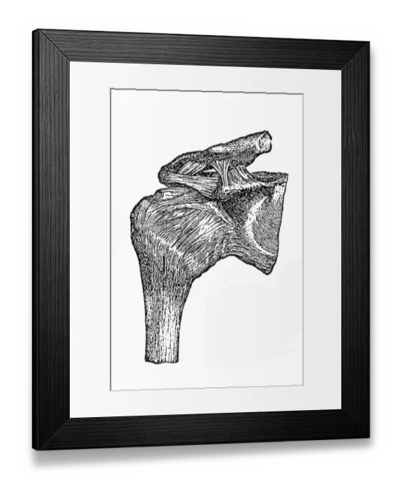 Framed Print : Humerus joint