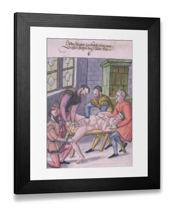 Framed Print : Operating Table Framed Print : Operating Table