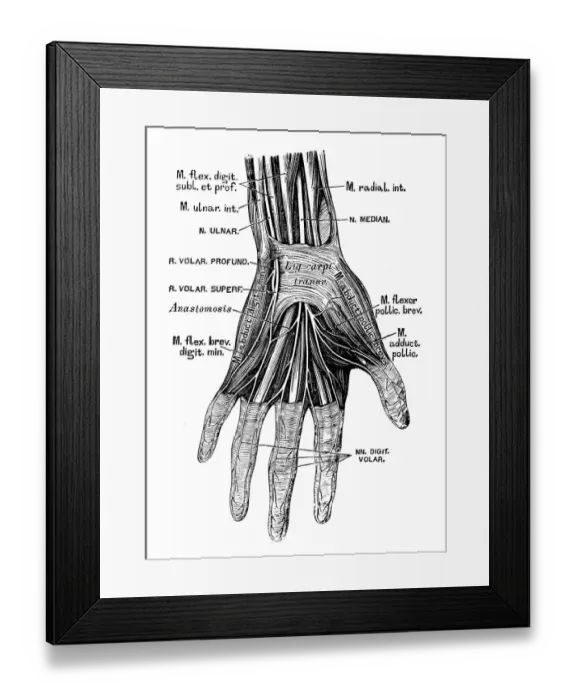 Framed Print : Human anatomy scientific illustrations: hand nerves Framed Print : Human anatomy scientific illustrations: hand nerves