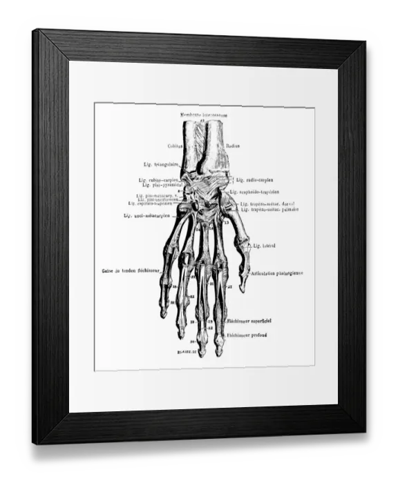 Framed Print : Hand bones Framed Print : Hand bones
