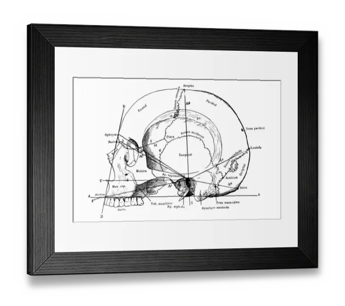 Framed Print : Human Skull with labels and measurements Framed Print : Human Skull with labels and measurements