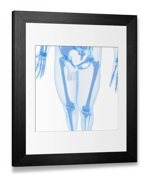 Framed Print : Leg bones, artwork Framed Print : Leg bones, artwork