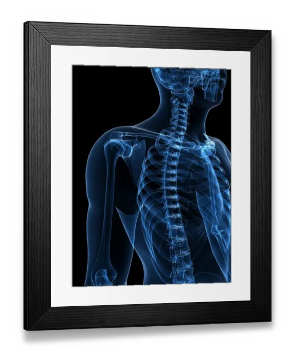 Framed Print : Upper body bones, artwork Framed Print : Upper body bones, artwork